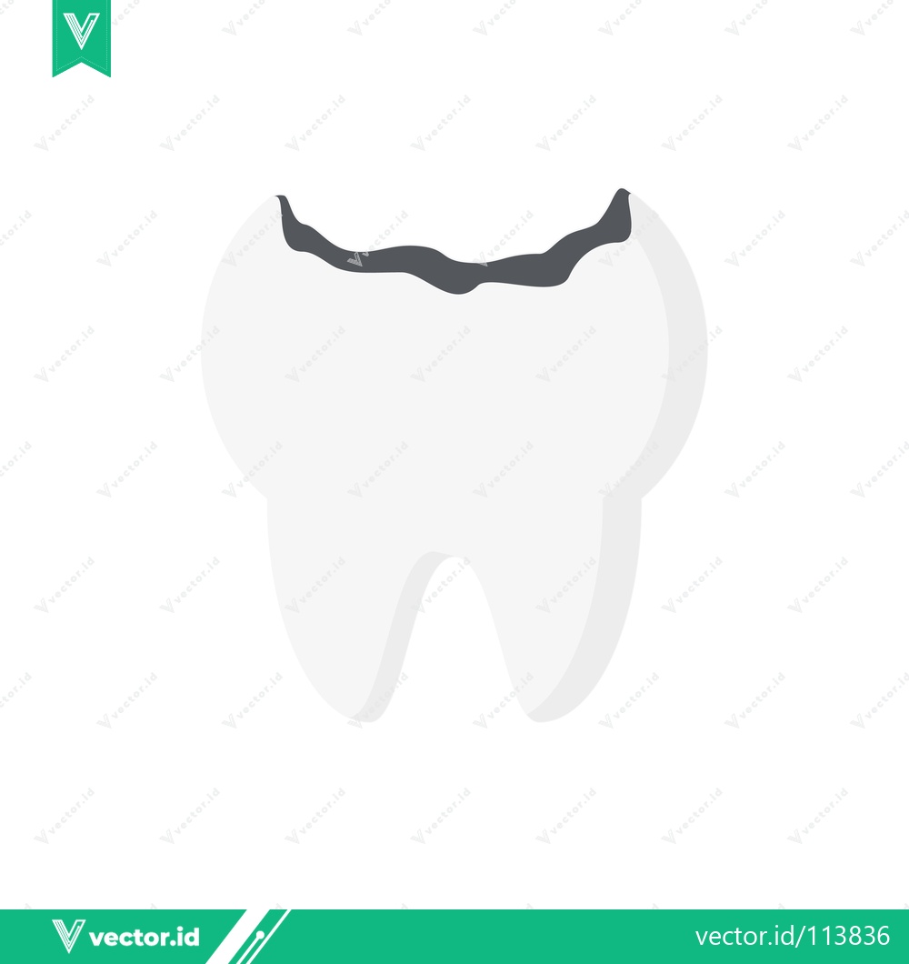 Premium Vector dari Illustration of a Cavity in a Tooth
