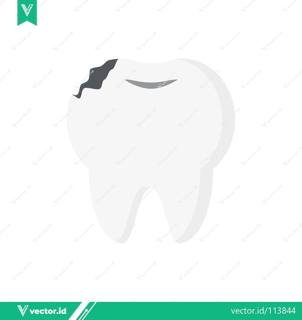 Premium Vector of Illustration of a Damaged Tooth with Cavity