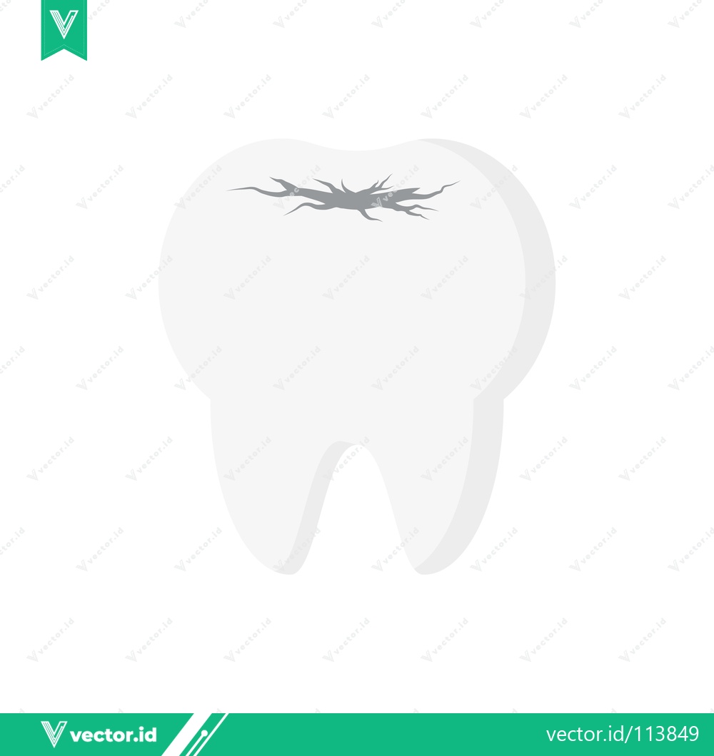 Premium Vector dari Illustration of a Cracked Tooth with Decay