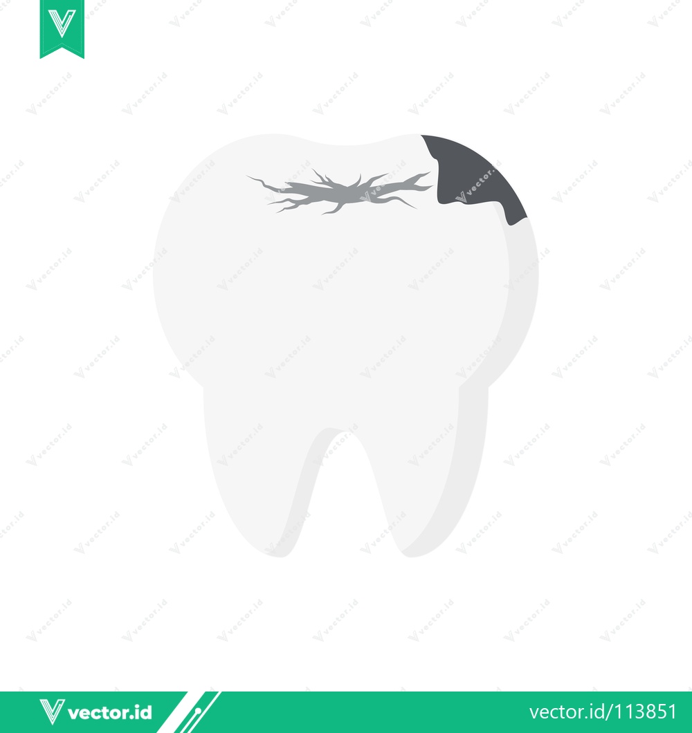 Premium Vector dari Illustration of a Cavity and Decay on a Tooth
