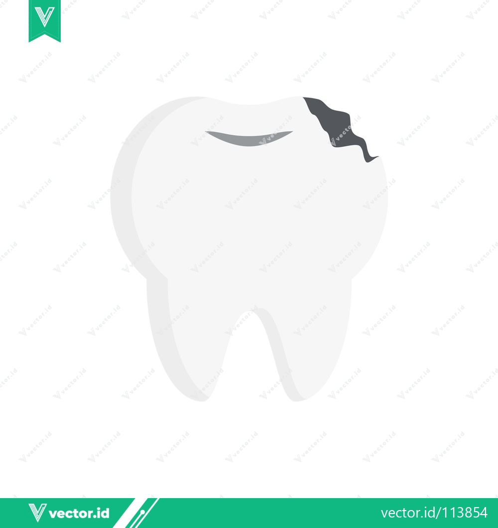 Premium Vector dari Illustration of a Damaged Tooth with Cavity and Decay