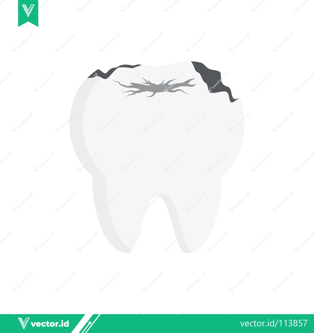 Premium Vector dari Illustration of a Damaged Tooth with Cavities and Decay