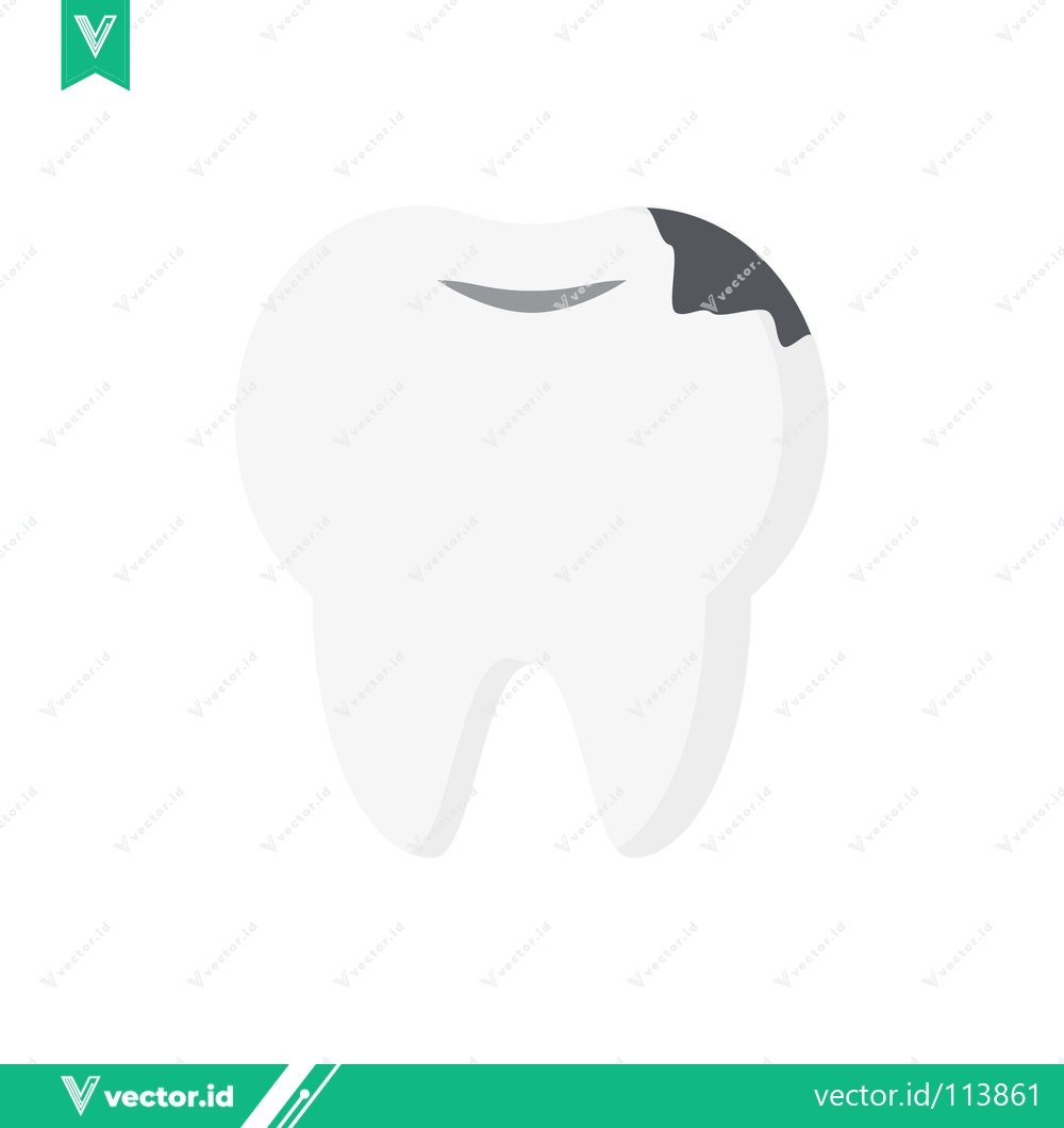 Premium Vector dari Illustration of a Cavity in a Tooth