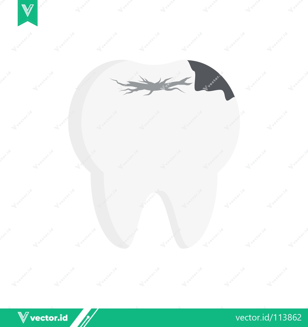 Premium Vector dari Illustration of a damaged tooth with a cavity and decay