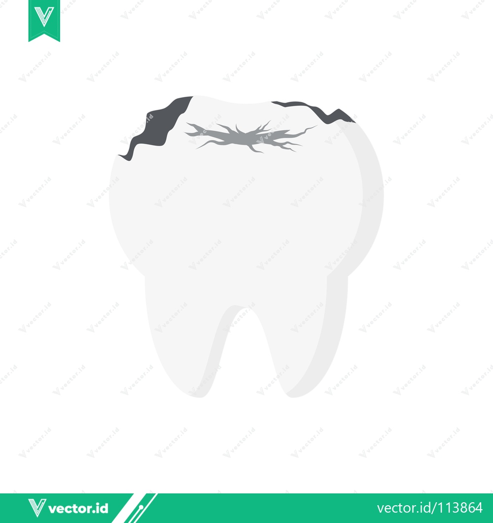 Premium Vector dari Illustration of a decayed tooth with dark spots and cracks on the chewing surface