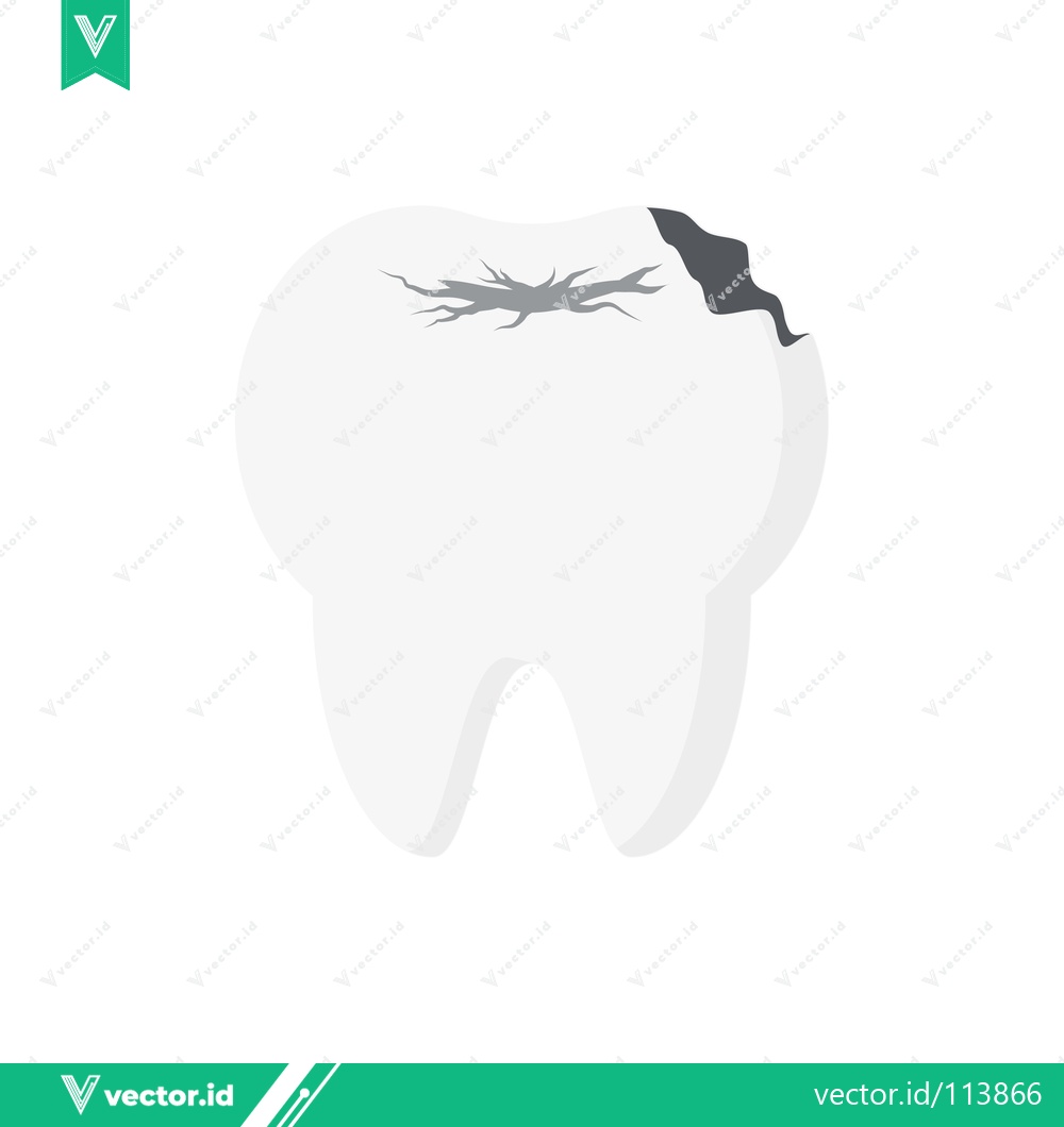 Premium Vector of Illustration of a Damaged Tooth with Decay and Cracks