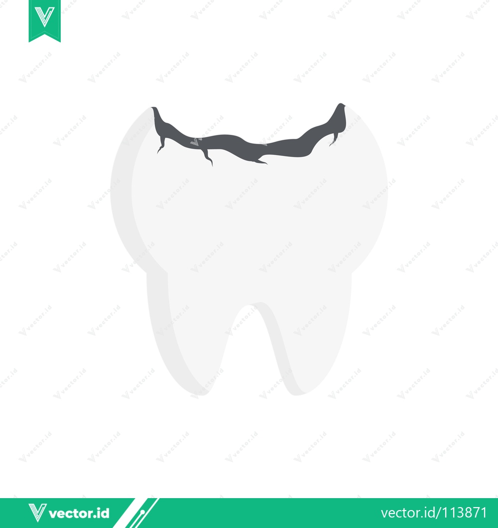Premium Vector dari Illustration of a Cavity in a Tooth