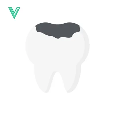 Illustration of a Cavity in a Tooth