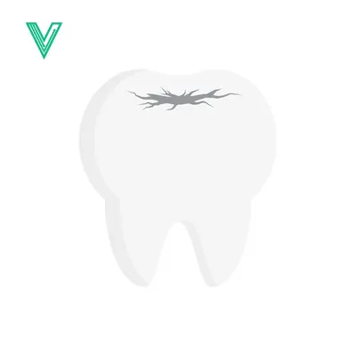 Cracked Tooth Illustration