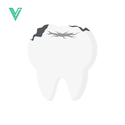 Illustration of a decayed tooth with dark spots and cracks on the chewing surface