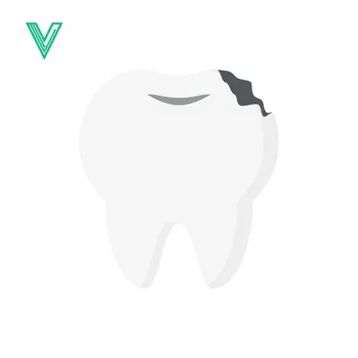 Illustration of a Cavity in a Tooth