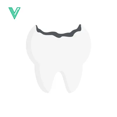 Illustration of a Cavity in a Tooth